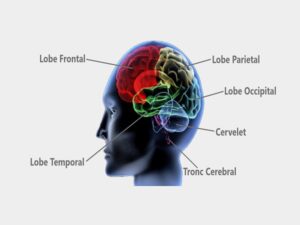 Cerebral Angiogram in India