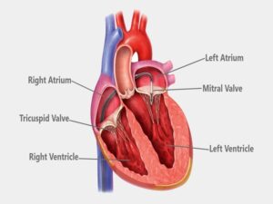 Mitral Valve Replacement Cost In India